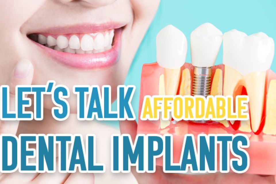 Let’s Talk Affordable Dental Implants