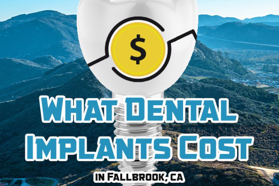 What Dental Implants Cost in Fallbrook